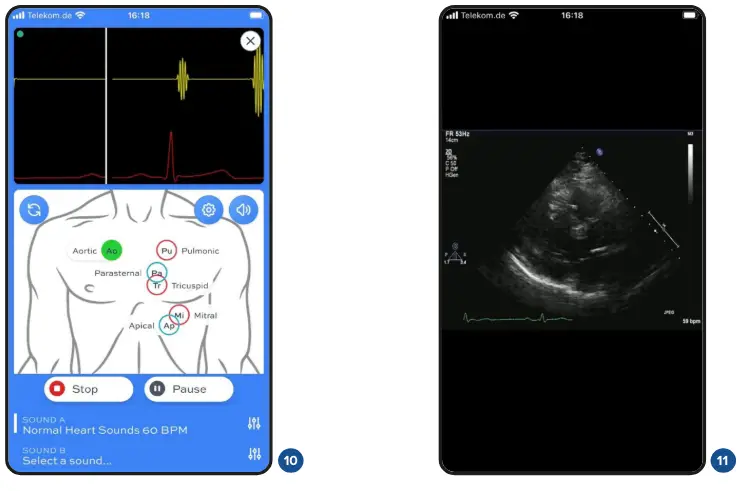 3B-Scientific-SAM4-Auscultation-Manikin-Light-Skin-fig- (5)