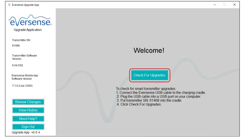 Apps Eversense Upgrade App Fig6