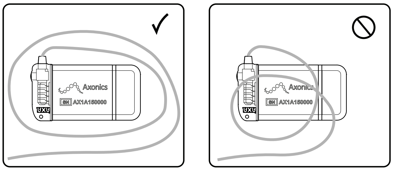 Implanting the Neurostimulator