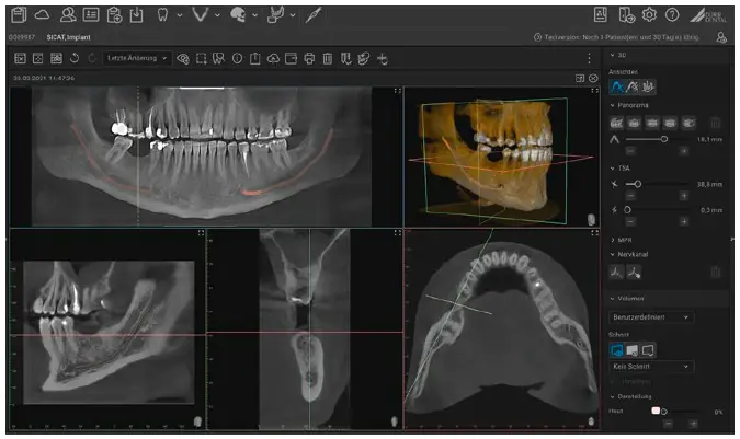 DURR-DENTAL-VistaScan-Mini-Easy-2.0-Eclipse-Dental-Engineering-Machine-Fig-13