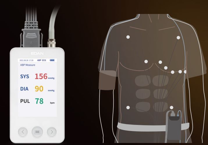 EDAN-SA-20-Holter-ECG-and-ABP-2-in-1-System-fig-1