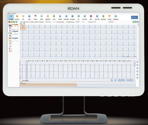 EDAN-SA-20-Holter-ECG-and-ABP-2-in-1-System-fig-2