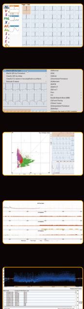 EDAN-SA-20-Holter-ECG-and-ABP-2-in-1-System-fig-3