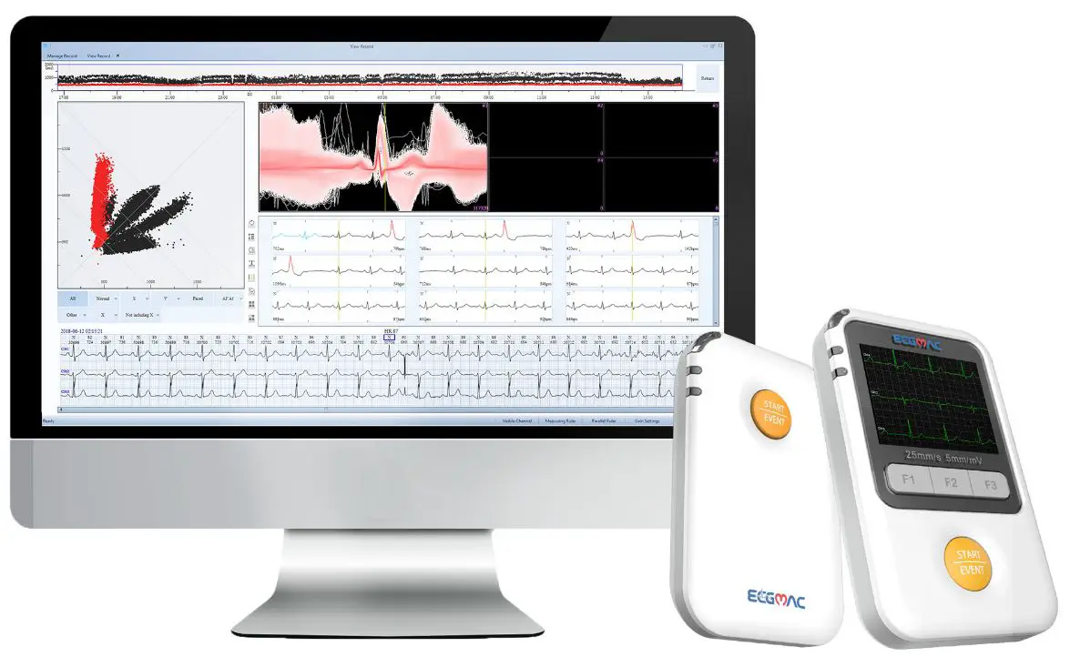EDAN-SA-20-Holter-ECG-and-ABP-2-in-1-System-product