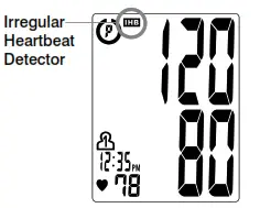 IRREGULAR HEARTBEAT DETECTOR