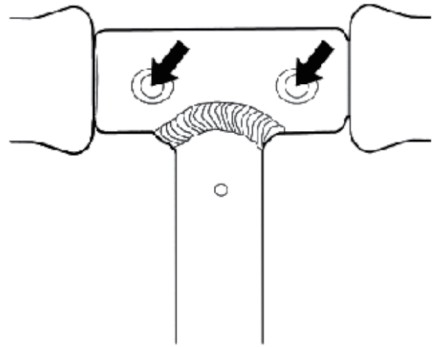 S200D Kick Scooter Foldable - parts3