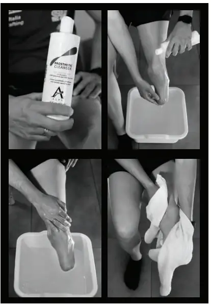 CLEANING THE RESIDUAL LIMB