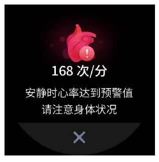 Heart Rate Alerts