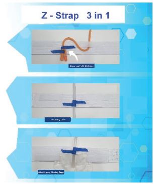GIMA-M28727NL-Z-Strap-3-In-1-Fixing-System-FIG-1