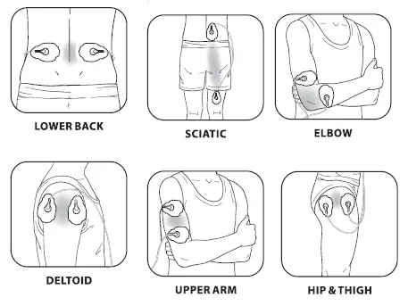 HealthmateForever-YK15AB-TENS-EMS-Muscle-Stimulator-fig- (5)