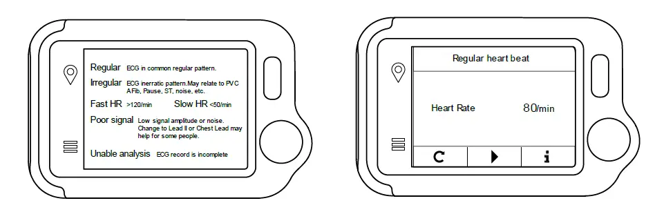 LiVENPaCE-0004-Portable-ECG-Monitor-10