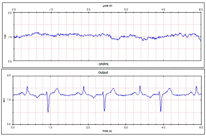 WHALETEQ SEEG 100 Single Channel EEG Test System - Sample waveform 7